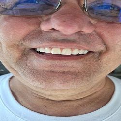 Raul novos dentes4-.jpg