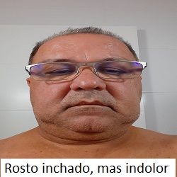 Raul pós-operatório1.jpg